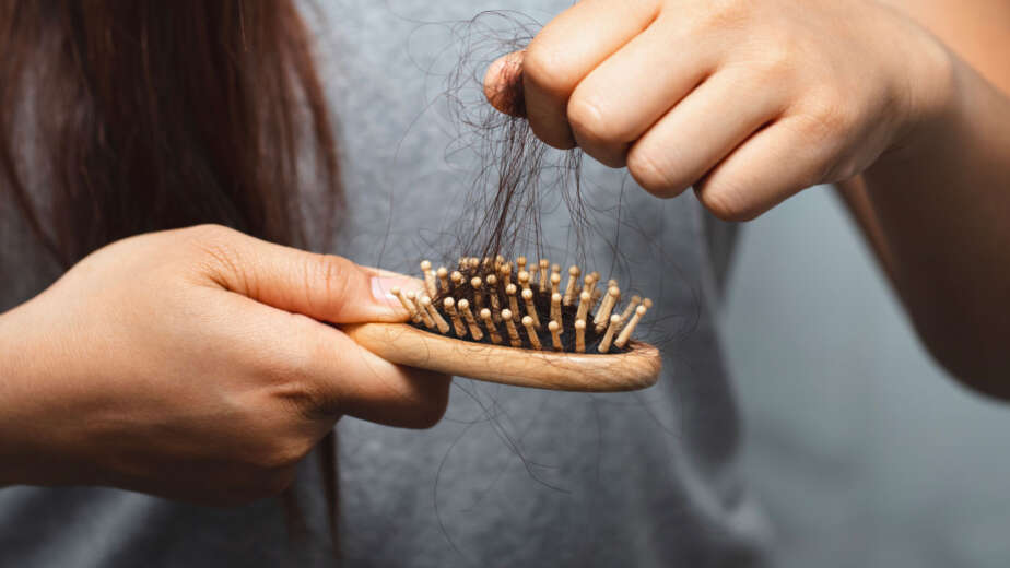 Perte de cheveux femme