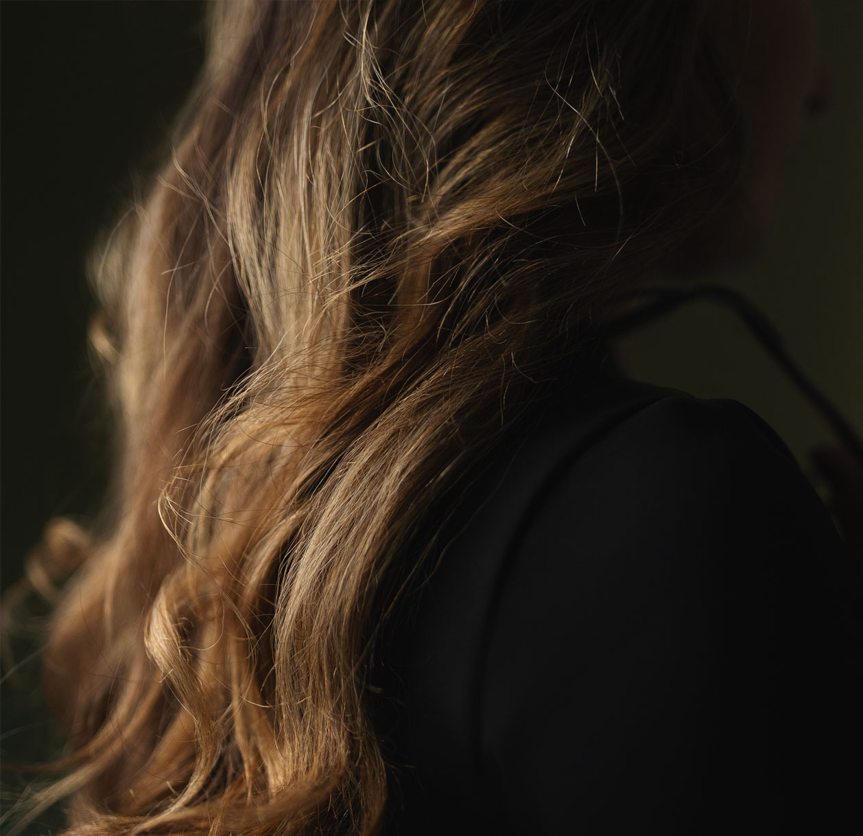 Greffe de cheveux femme